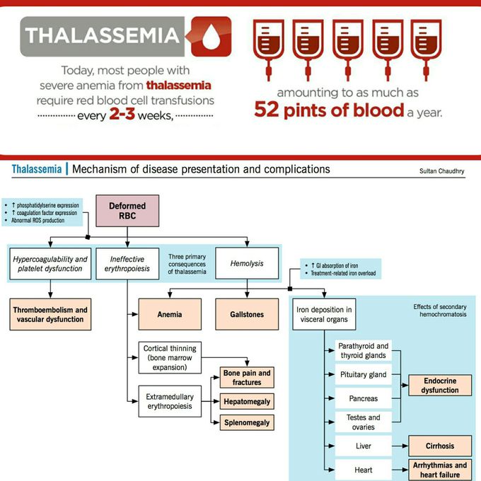 Mechanism of thalassemia and complications