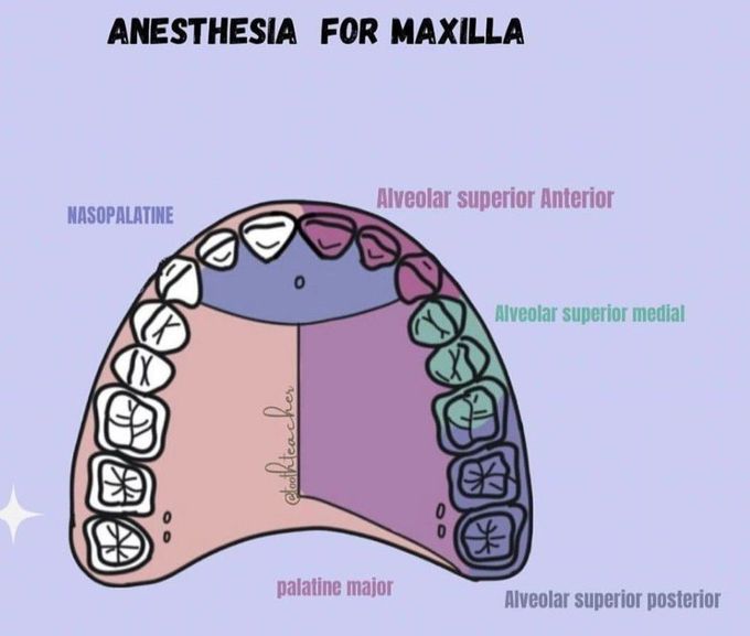 Anesthesia for Maxilla