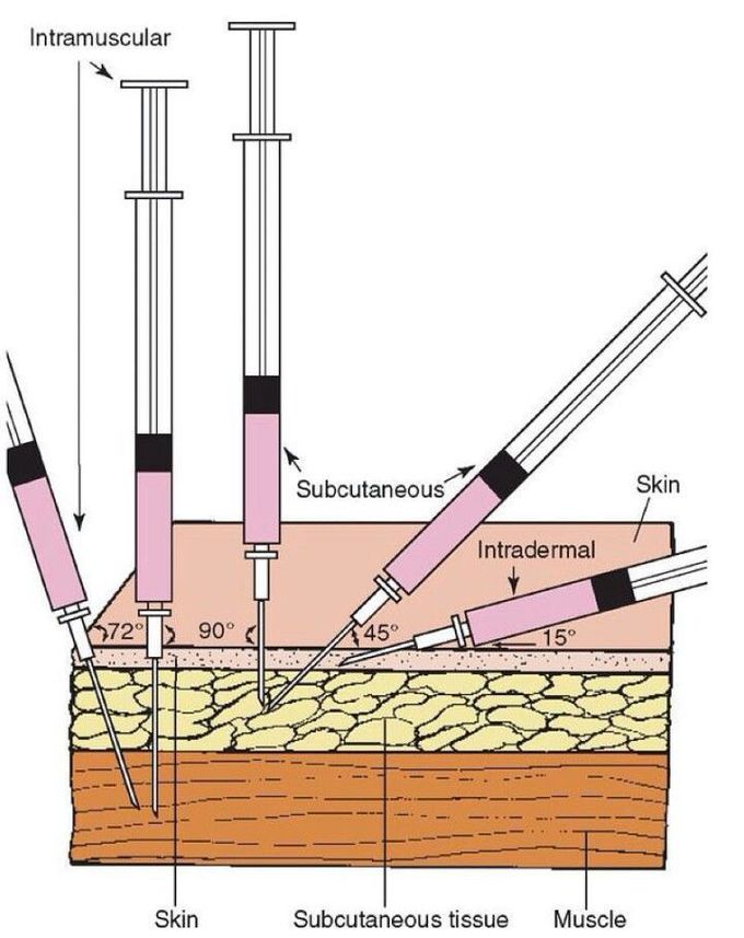 Injections