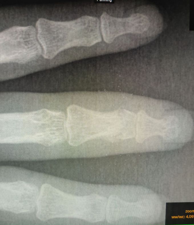 Diagnosis?