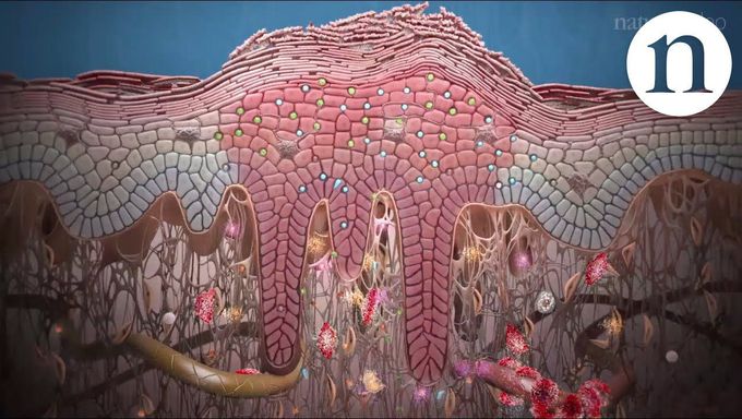 Psoriasis and beyond: targeting the IL-17 pathway