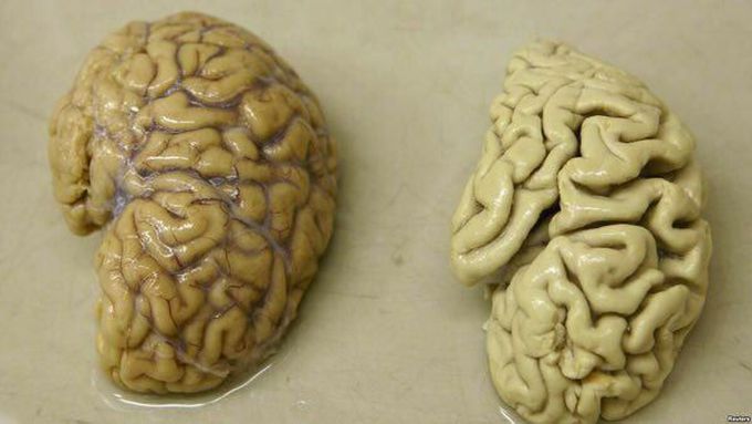 brain
