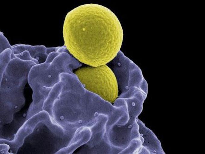 White blood cell engulfing bacteria
