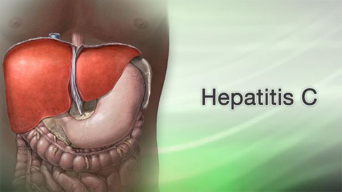Treatment for Hepatitis C