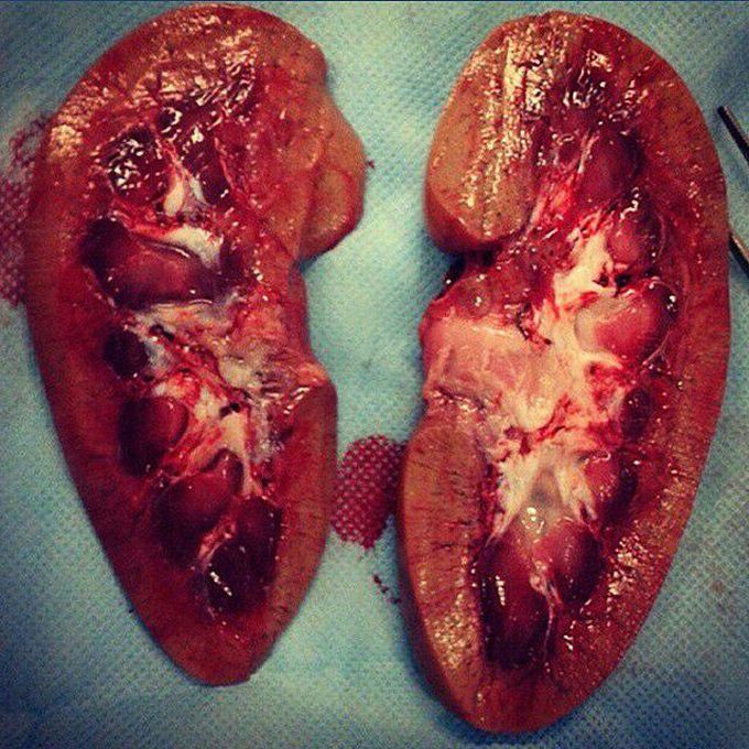 Cross section of the human kidneys