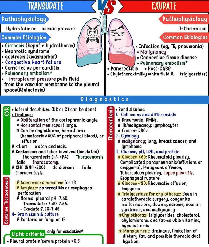 Transudate Vs Exudate