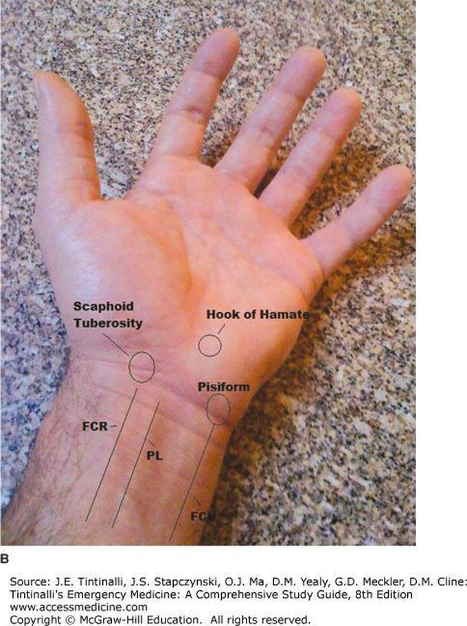 wrist-medizzy