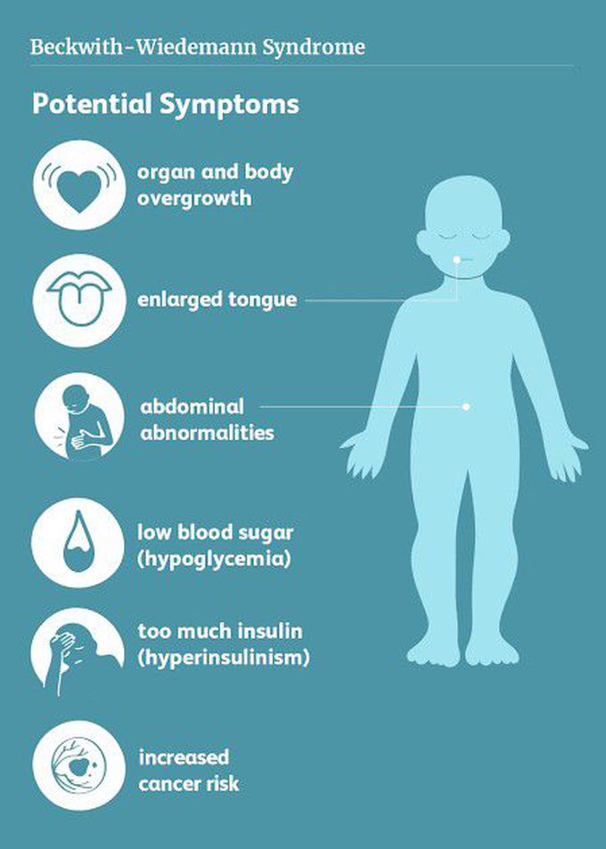 These are the main symptoms of Beckwith-widemann syndrome
