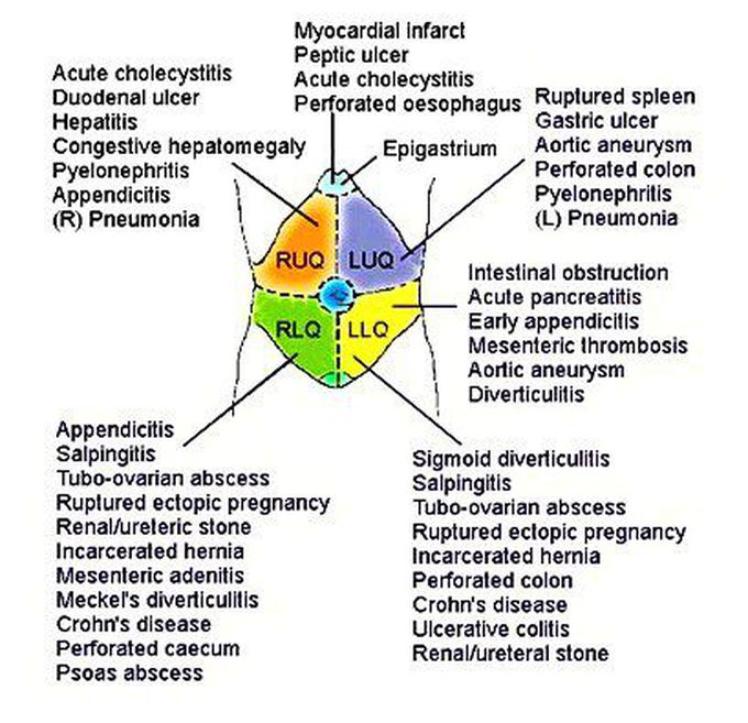 Differential Diagnosis Of Abdominal Quadrants Medizzy