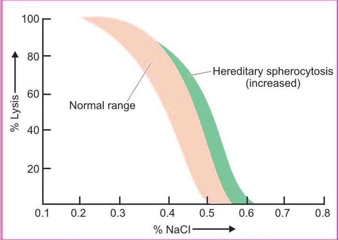 Osmotic fragility test