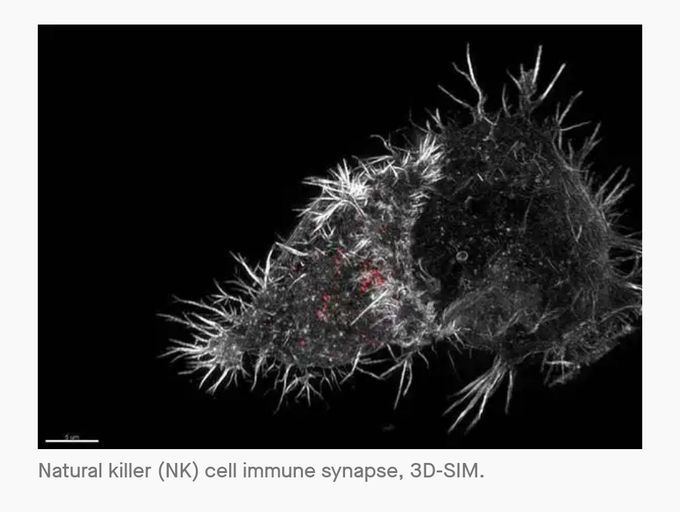 💥Natural killer cell - electron microscopic view