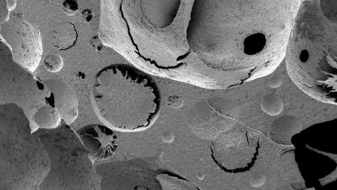 Lab-Made Artificial Human Bone Marrow Is Pure Scientific Wizardry