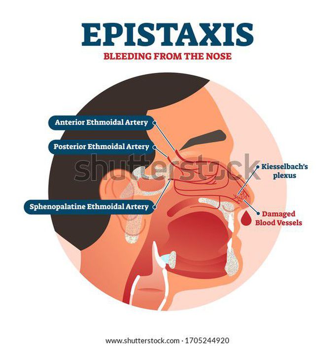 Kiesselbach's Plexus and Little's area