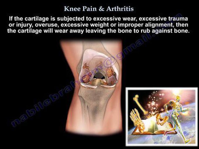 Knee diseases-Orthopedic surgery