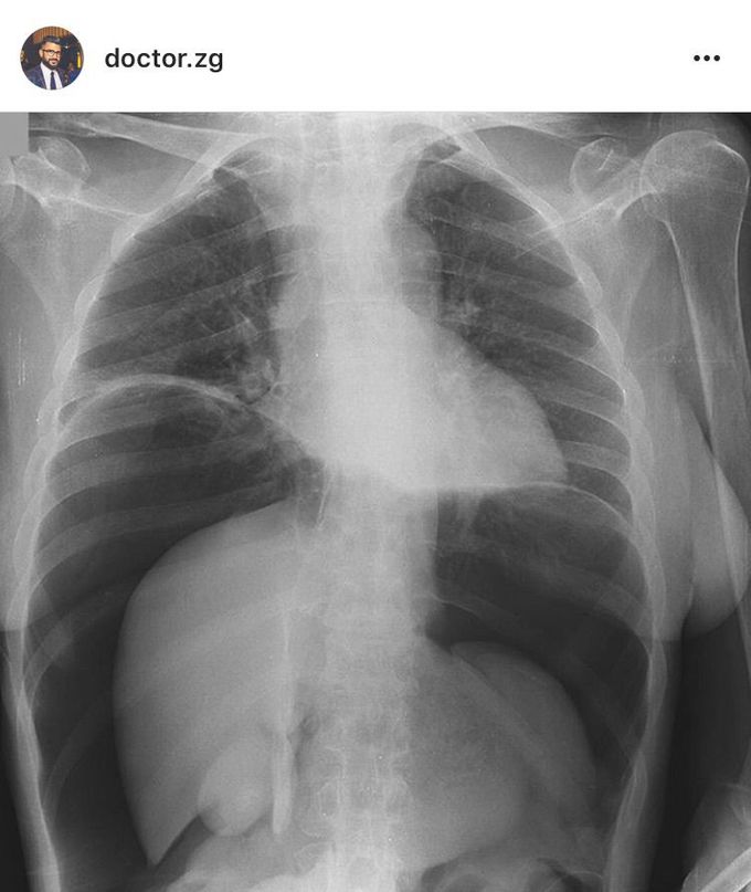 Dx?