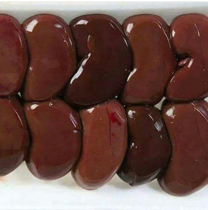 SOFT AND PHOTOGENIC HUMAN KIDNEYS