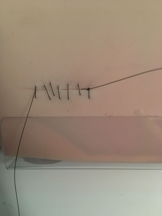 Suture