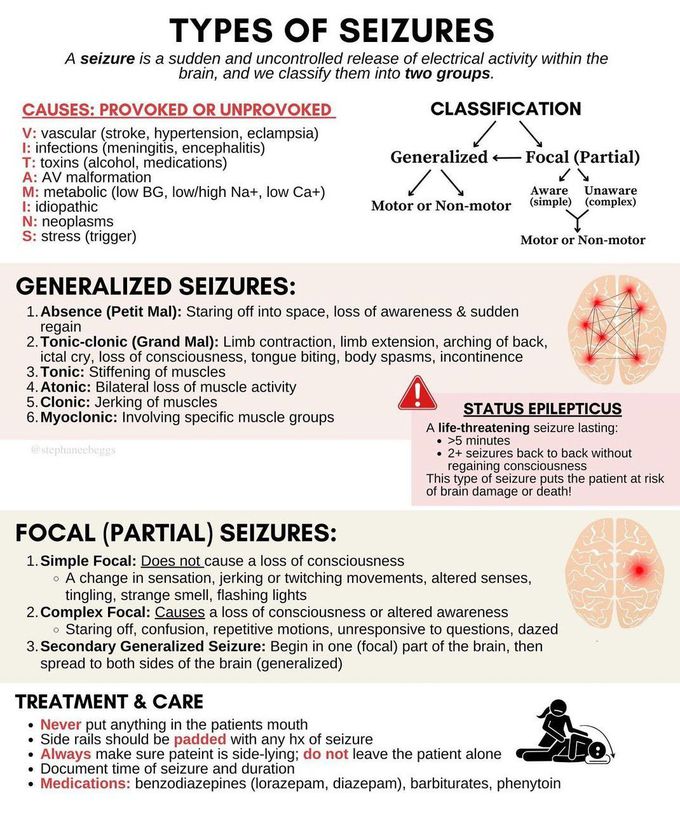 Types of Seizure