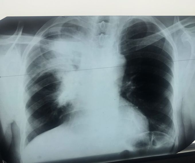X- ray description