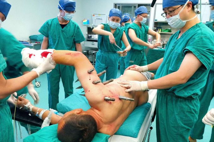 Factory robot malfunctions and impales worker with 10 foot-long steel spikes