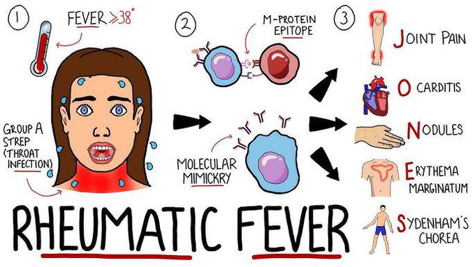 What is rheumatic fever?