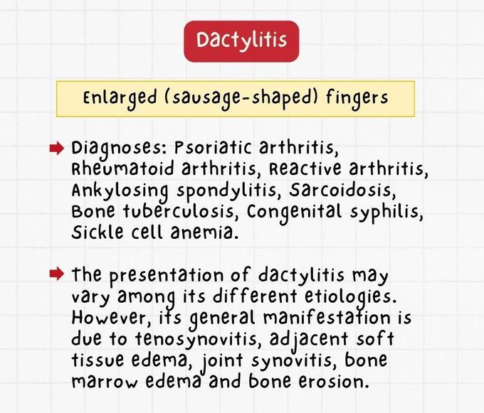 Dactylitis