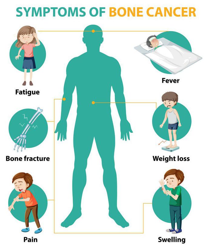 Bone cancer