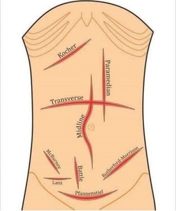 Anatomical marking