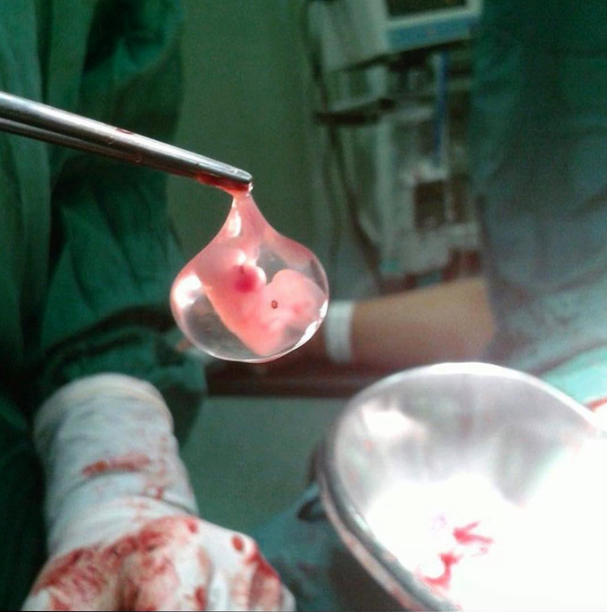 Little embryo