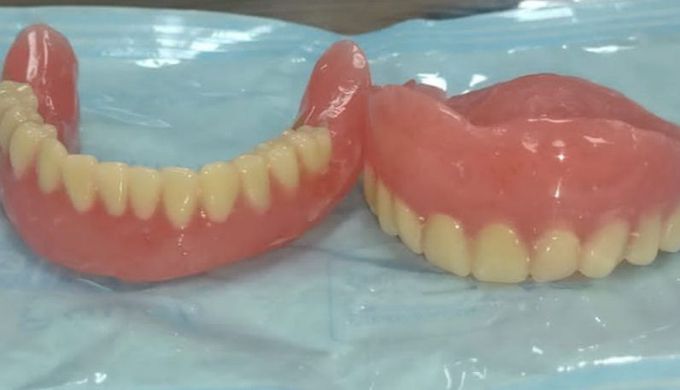 Complete Denture