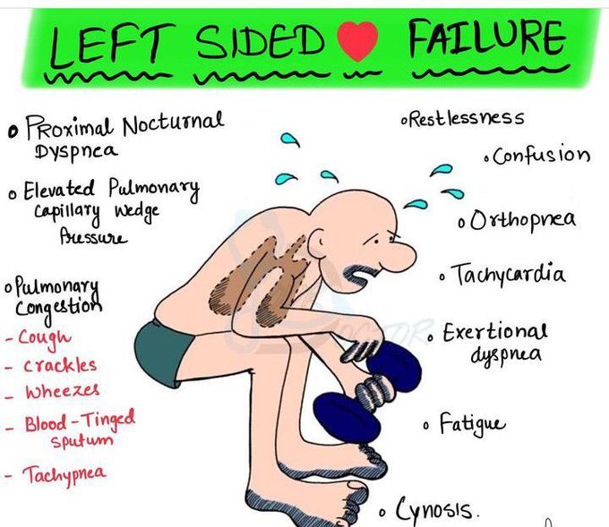 Left-sided Heart Failure - MEDizzy