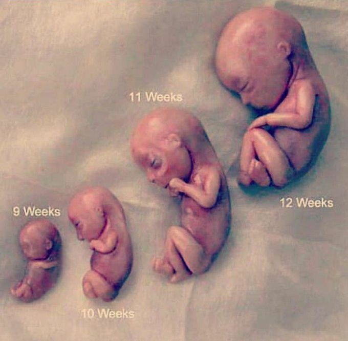 Different stages of fetal development 🐸