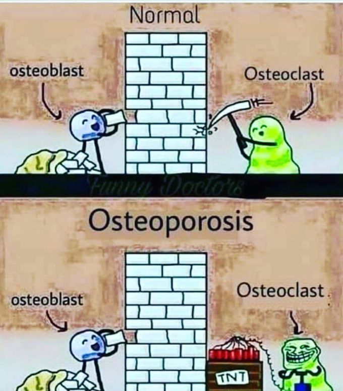 OSTEOPOROSIS