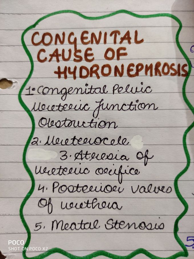 I have written congenital causes of hydronephrosis 🖤