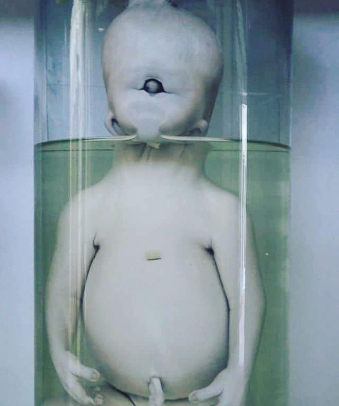 Cyclopia