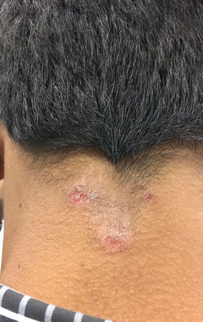 What is your diagnosis???