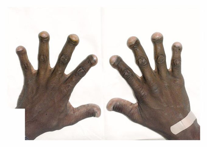 What is your diagnosis???