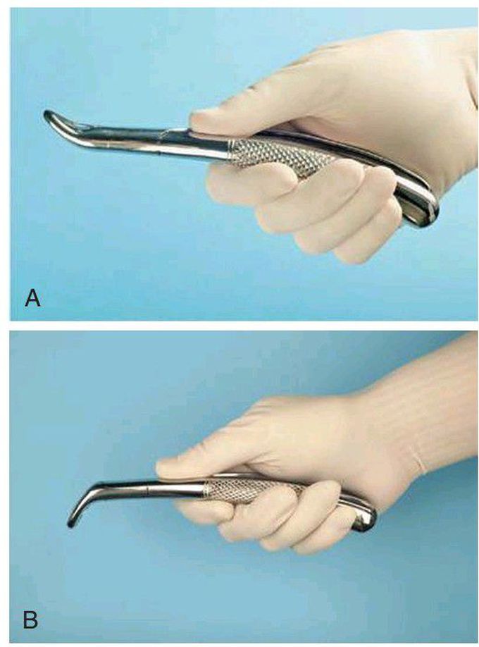 Extraction forceps handling