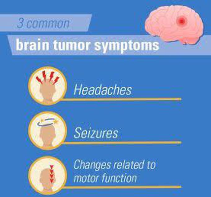 These are the common symptoms of brain tumor
