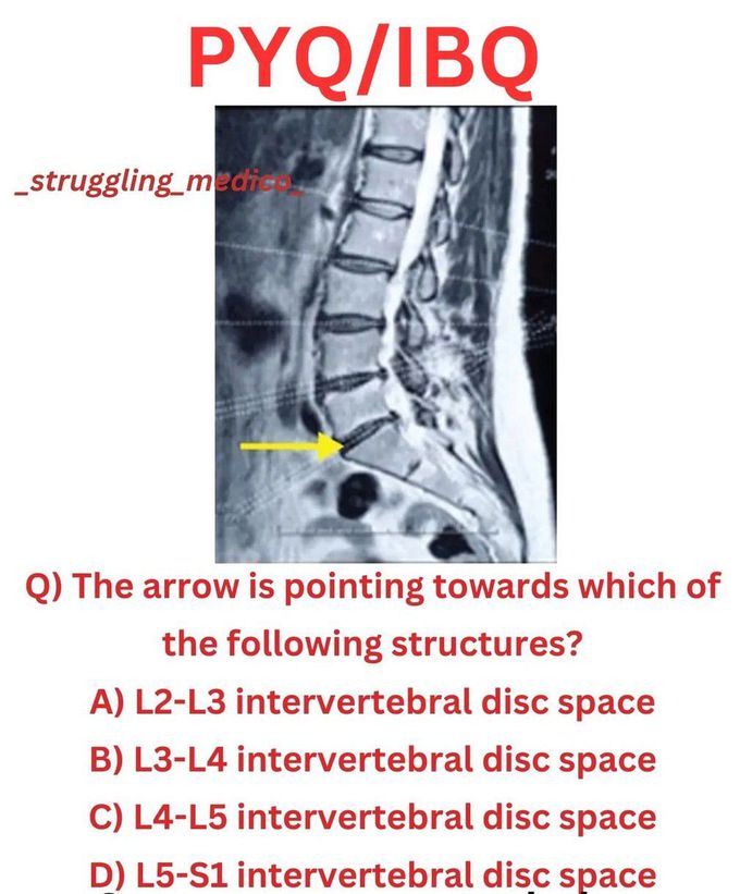 Identify the Structure