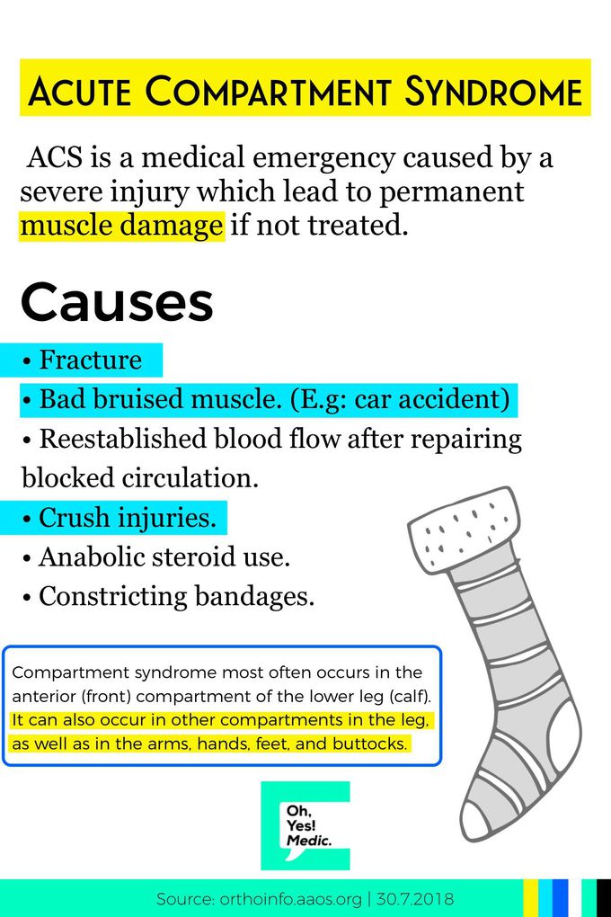 ACS (what’s that?) compartments syndrome? Yes!