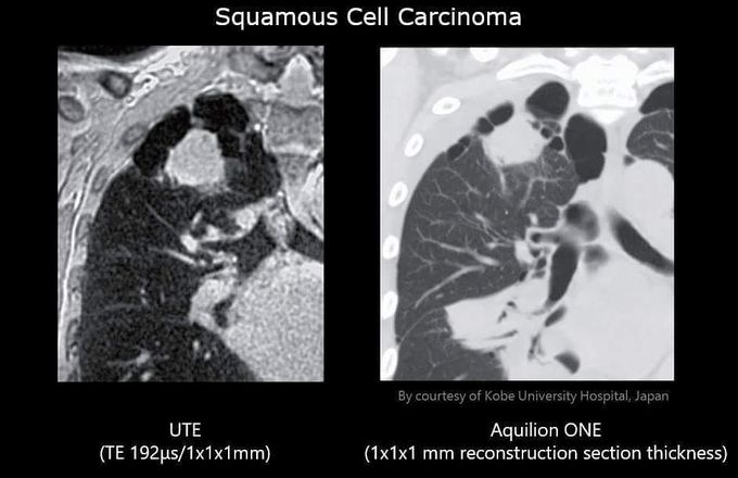 Imaging of lung tissue