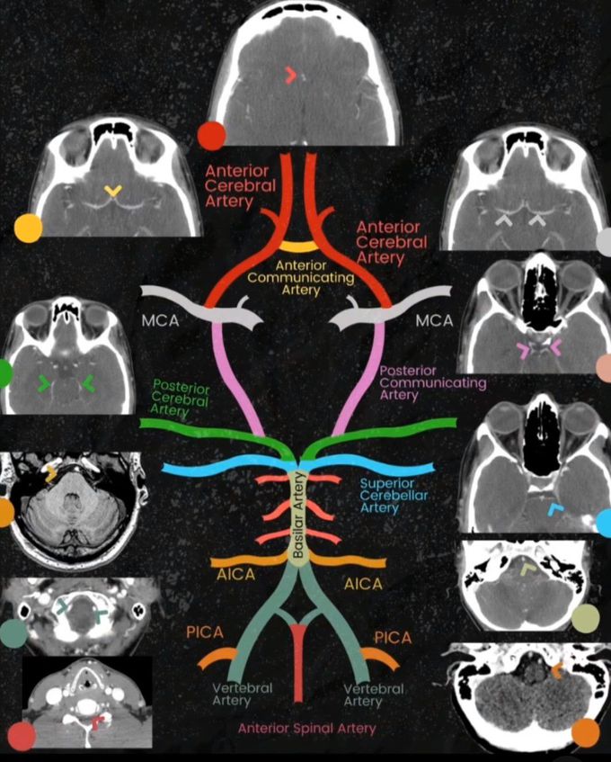 Circle of Willis