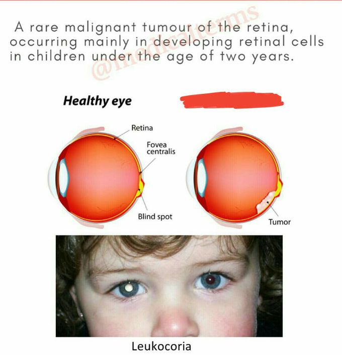 What's your diagnosis??