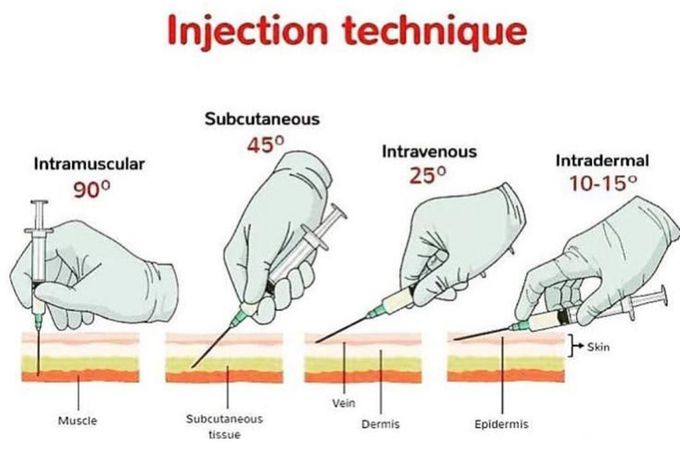 INJECTION TECHNIQUES