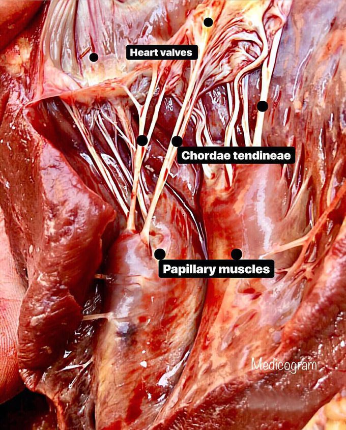 Papillary muscles & cordae tendineae (Heart strings) of the heart