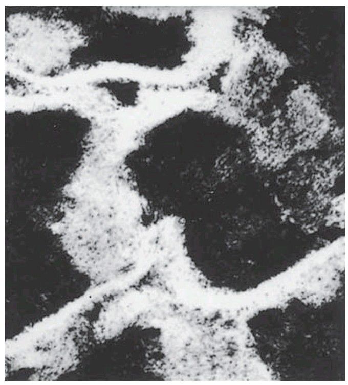 Chalky enamel