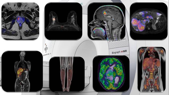 Multimodality imaging