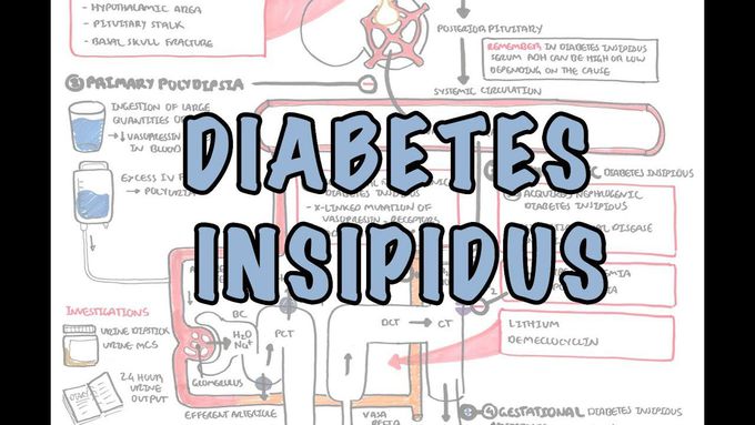 Diabetes Insipidus