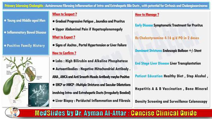 Primary Sclerosing Cholangitis